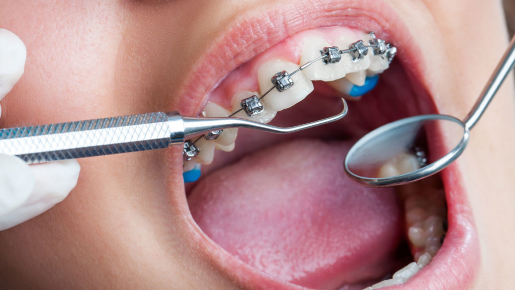 Orthodontics 5 Orthodontic